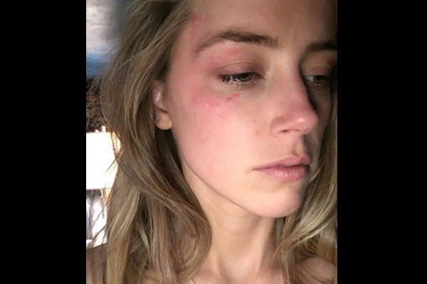 Esposa de Johnny Depp pide orden de alejamiento en contra del actor por supuesta violencia doméstica