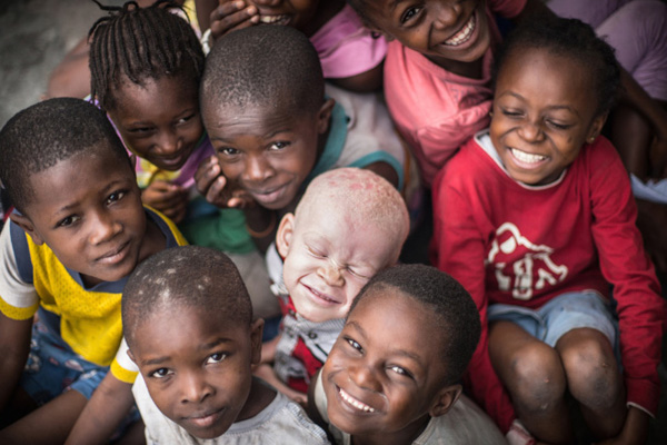 Albinos en África: Mira cómo una fotógrafa quiere devolverles 