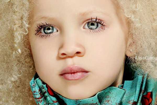 Ava Clarke, la pequeña albina afromericana que conquista al mundo de la moda