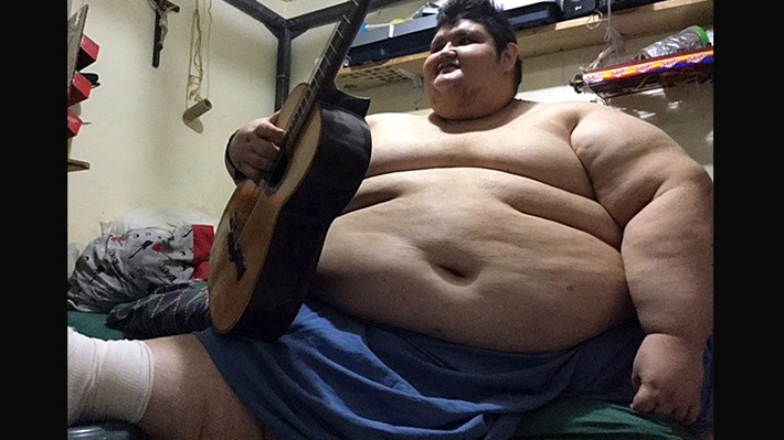 Pesa 500 kilos: Hombre más obeso del mundo iniciará esta semana un tratamiento para salvar su vida