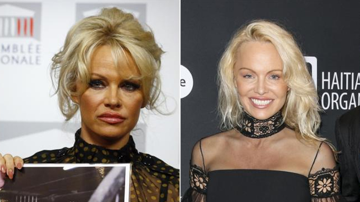 Una irreconocible Pamela Anderson reaparece con rostro rejuvenecido en gala benéfica