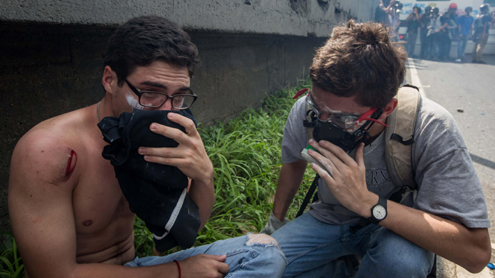 Joven de 19 a&ntilde;os muere tras herida de bala en protesta en Venezuela