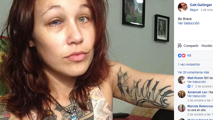 Modelo canadiense quiso tatuarse el globo ocular y ahora está parcialmente ciega