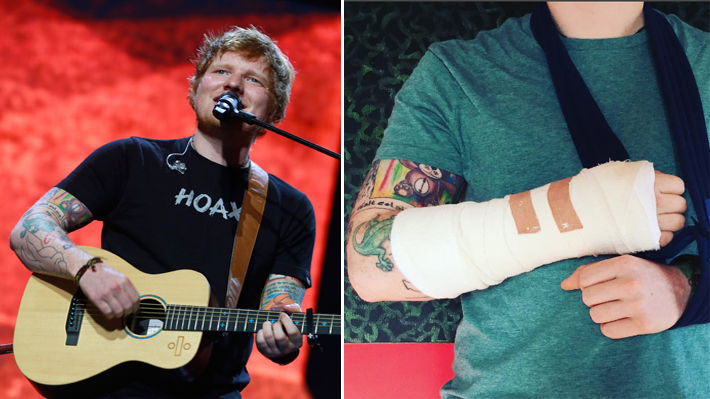 Ed Sheeran sufre un accidente en bicicleta, lo que pone en riesgo las pr&oacute;ximas fechas de su tour por Norteam&eacute;rica