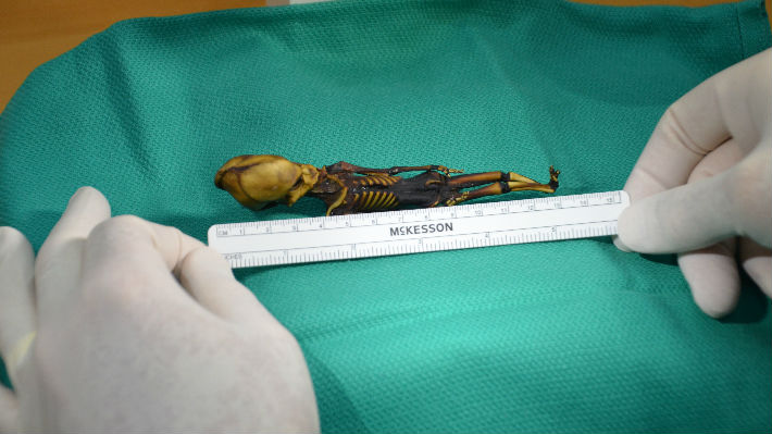 Estudio comprobó que el "esqueleto de Atacama" es en realidad un bebé con mutaciones y no un alienígena