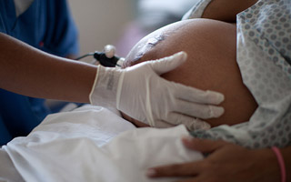 Una mujer muere cada una semana en Chile por causas asociadas al parto: &#34;No da lo mismo dónde y cuándo nacer&#34;