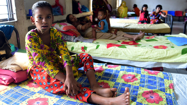 Operan con &eacute;xito a ni&ntilde;a banglades&iacute; que tendr&iacute;a s&iacute;ndrome del 