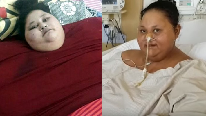 Era la m&aacute;s obesa del mundo: Mujer pierde 250 kg tras operarse en la India