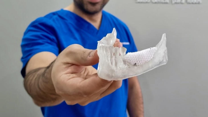 Emprendimiento de la Región de Los Ríos desarrolla matriz 3D capaz de regenerar los huesos del área bucal