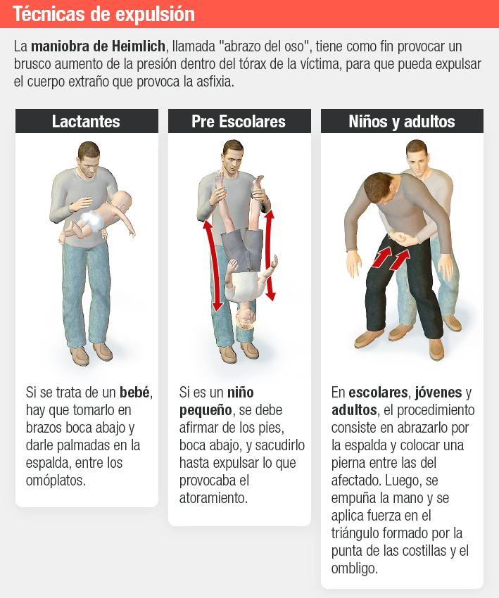Maniobra de heimlich en ninos video