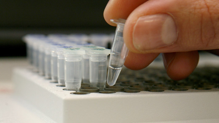 Científicos revelan un posible nuevo tratamiento para el cáncer de próstata