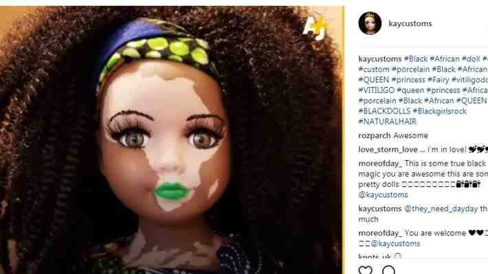 Artista diseña muñecas con vitiligo para romper los estereotipos de belleza