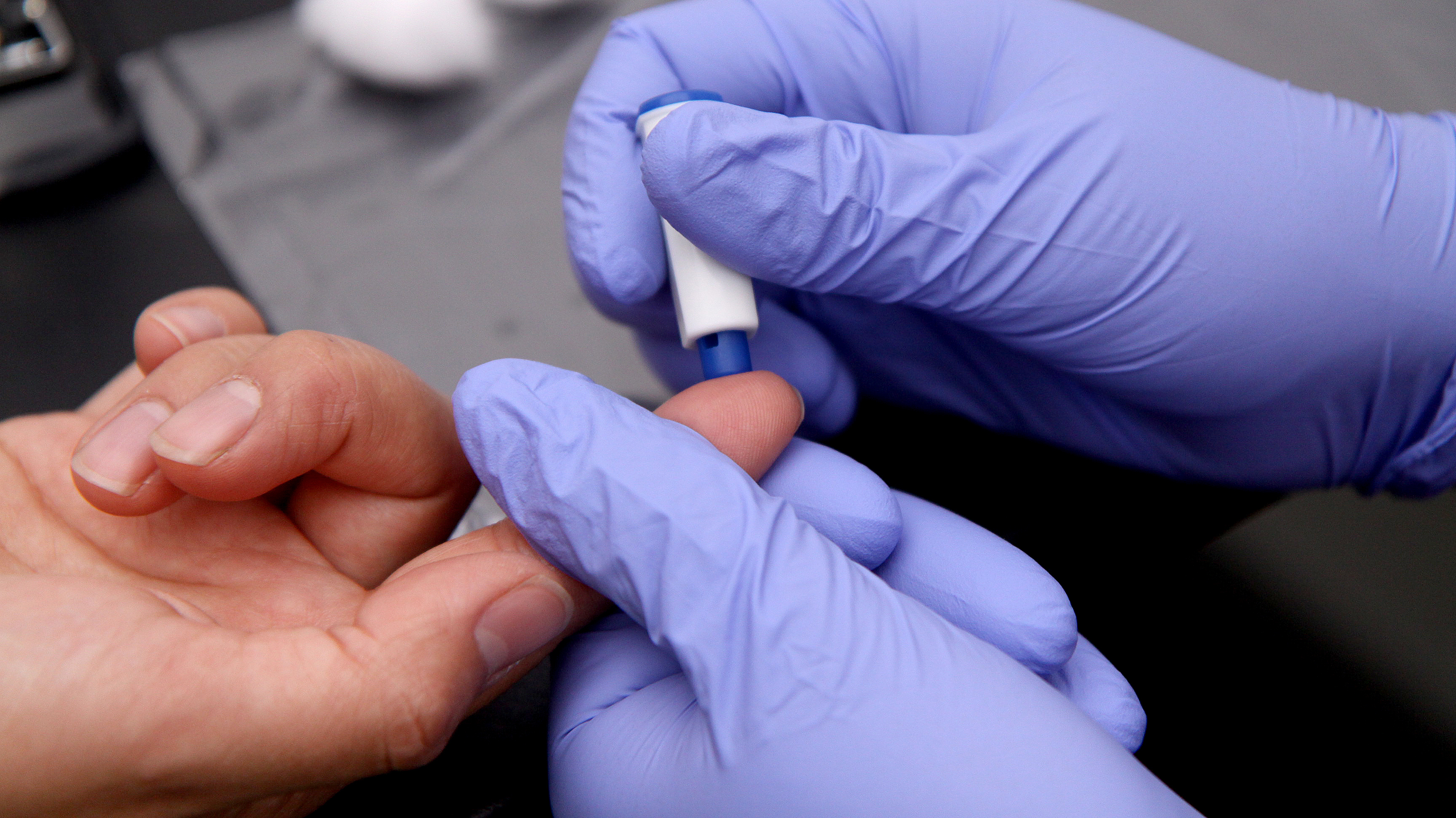 Falta de información y difícil acceso al test: Las causas del aumento de contagios por VIH