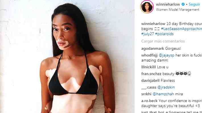 Winnie Harlow, la modelo con vitíligo que celebra ser la nueva "ángel" de Victoria's Secret