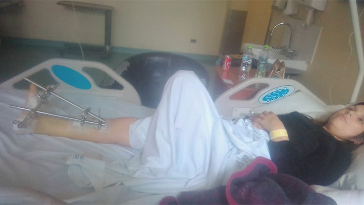 Nabila Rifo sufre múltiples fracturas en su pierna al caer por la escalera de su hogar