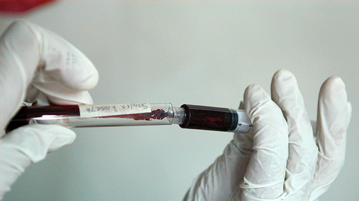 Cada vez más cerca de una vacuna: Identifican pautas para desarrollar anticuerpos universales contra el VIH