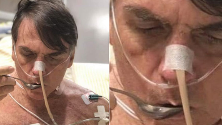 Bolsonaro mejora de cuadro de neumonía tras complicaciones posoperatorias
