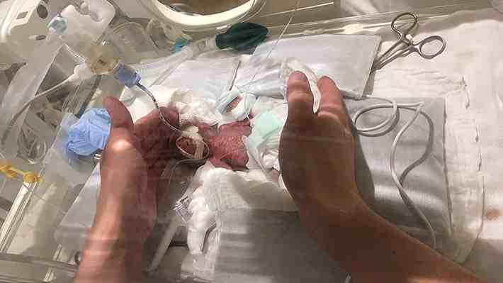 Hospital japonés celebra el alta de un niño prematuro que solo pesó 268 gramos al nacer