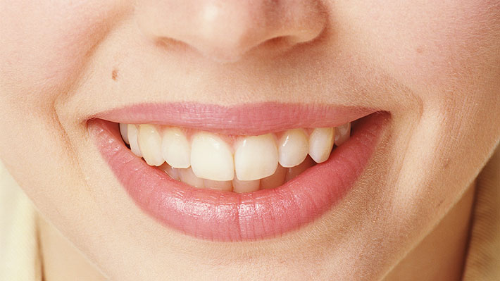 Estudios advierten que las tiras blanqueadoras impactan las capas más profundas de los dientes