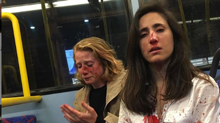 Las obligaron a besarse, las golpearon y les robaron: El violento ataque lesbofóbico que remece a Londres