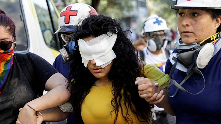 Organismos difieren en número de pacientes con trauma ocular y precisar la cifra se torna complejo