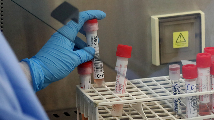 Minsal informa de 14 nuevos casos de coronavirus en el país: Cifra llega a los 75 contagiados