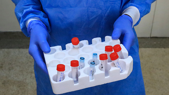 Casi 10 mil exámenes de PCR, más testeo y aumento de laboratorios: Minsal explica las causas del récord en reporte de casos
