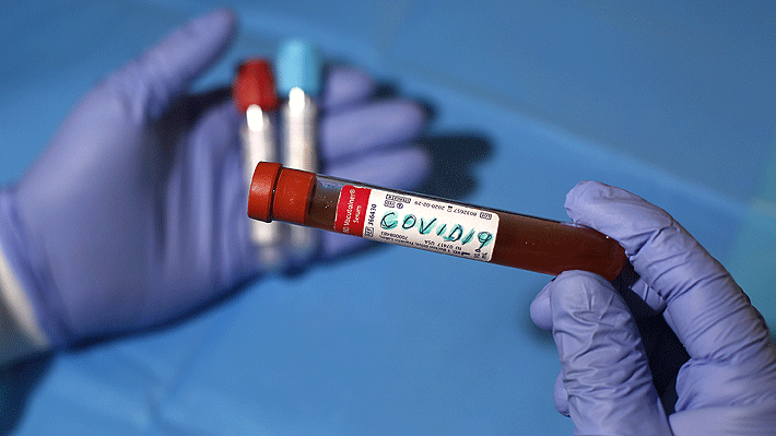 Salud suspende permisos de cinco laboratorios por errores en resultados de test de covid-19