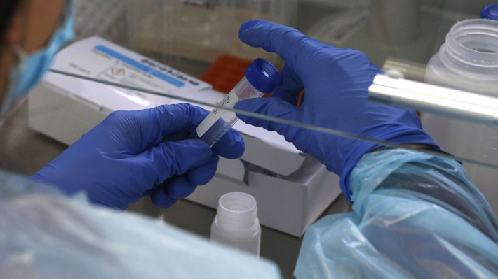 Nuevo laboratorio chino se suma a conversaciones con Chile para pruebas de vacuna contra covid-19