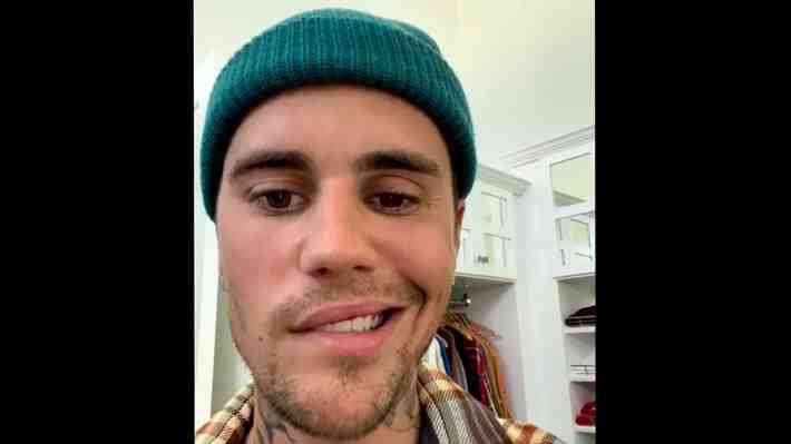 ¿Qué es el síndrome de Ramsay Hunt? La extraña patología que provocó la parálisis facial de Justin Bieber