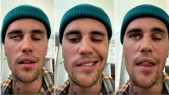 Justin Bieber reanuda gira mundial tras cancelarla por contraer virus que paralizó la mitad de su rostro