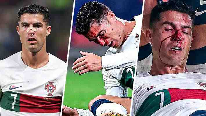 Un golpe durísimo y con sangre en la cara: El impactante choque de Cristiano Ronaldo con arquero checo en goleada de Portugal
