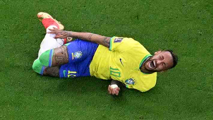 Las imágenes del tobillo de Neymar que preocupan a Brasil y qué dijo el médico de la selección