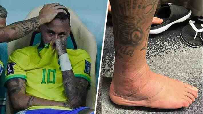 La impactante imagen que publicó Neymar de su tobillo lesionado y la preocupación por su futuro en el Mundial