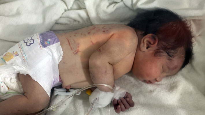 Rescatan a recién nacida con cordón umbilical entre los escombros tras  terremoto en Siria: Su madre murió atrapada | Emol.com
