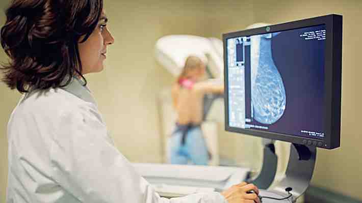 Las mamografías apoyadas con inteligencia artificial detectan 20% más el cáncer de mama