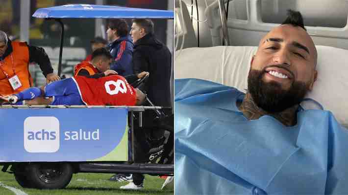 Arturo Vidal ya fue operado y se perdería el resto del año... Revisa el parte médico