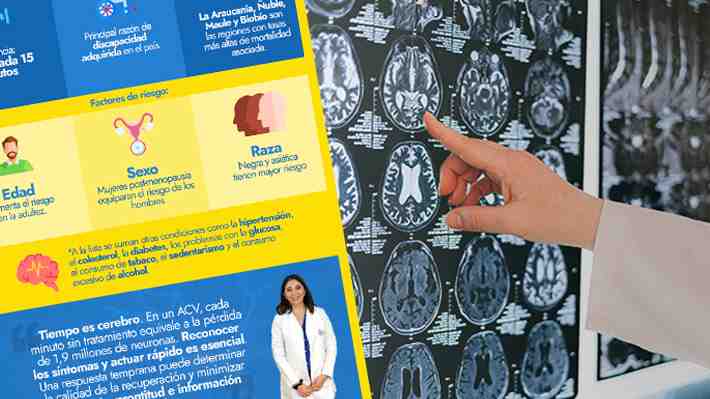Tras problema de salud de Carlos Caszely: Los siete síntomas que debes conocer para actuar a tiempo ante un ACV