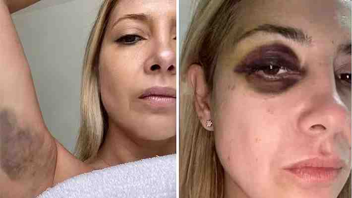 Argentina: Las imágenes que la expareja de Alberto Fernández presentó como pruebas para denunciarlo por violencia de género