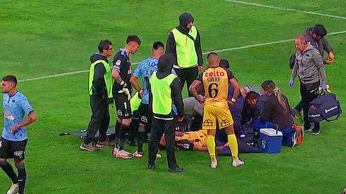 La escalofriante lesión que sufrió joven delantero de Coquimbo Unido ante O'Higgins