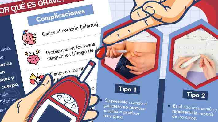 Unos 240 millones viven con diabetes y no se han diagnosticado: Las cifras y proyecciones que dibujan su silencioso avance