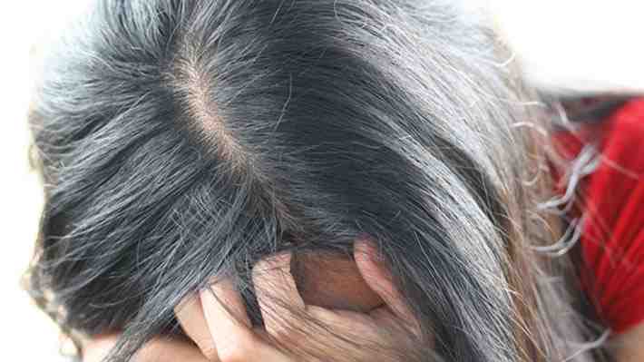 Causas, factores de riesgo y cómo prevenir la alopecia, afección que originó la broma de Chris Rock a esposa de Will Smith