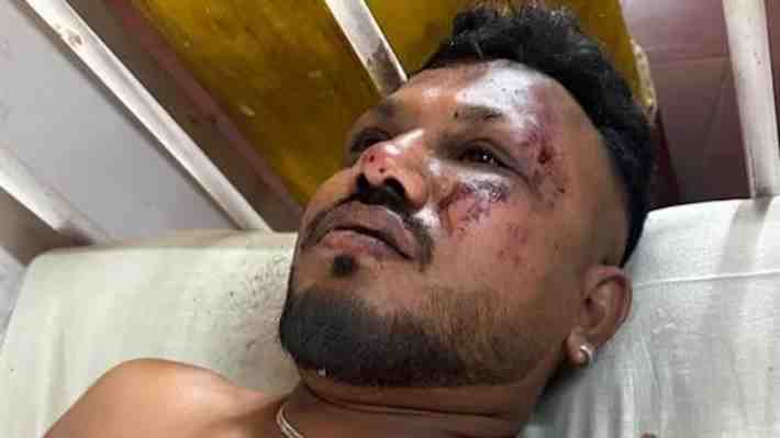 Quién es Vishwash Kumar Ramesh, el único sobreviviente de la tragedia aérea en India