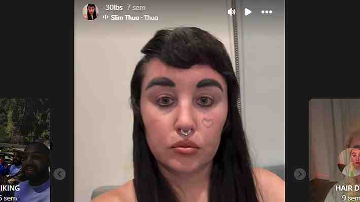 Exactriz Amanda Bynes muestra en redes sociales el resultado de su último tratamiento estético