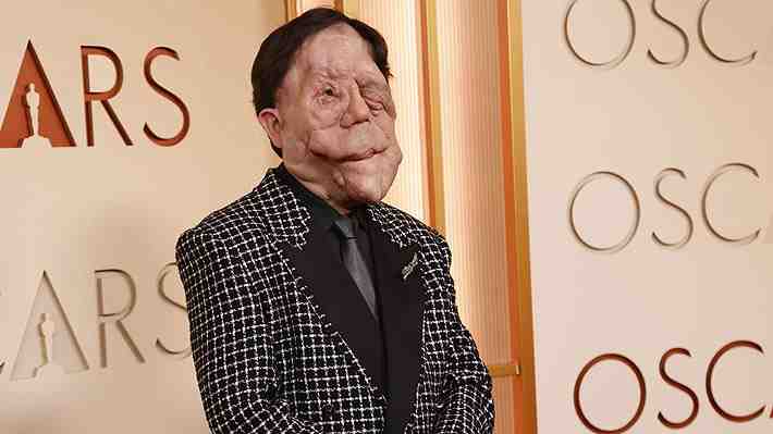 Qué es la neurofibromatosis, la enfermedad que el actor Adam Pearson quiso visibilizar en la gala de los Oscar 2026