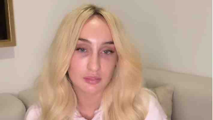 "Caí en un hoyo y no encontraba la salida": Fran Maira rompe el silencio tras accidente que mantiene grave a motorista