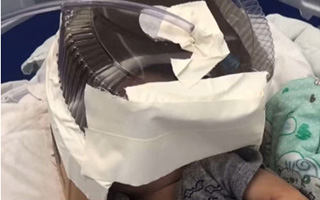 Hospital en Brasil improvisa una máscara de oxígeno para guagua de 3 meses con el envase de una torta