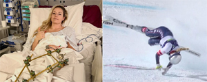 Casi pierde la pierna: El desgarrador relato de mítica esquiadora tras escalofriante accidente en los JJ.OO. de Invierno... Mira las imágenes