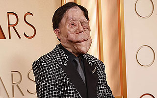 Qué es la neurofibromatosis, la enfermedad que el actor Adam Pearson quiso visibilizar en los Oscar