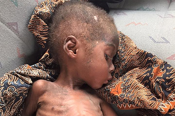La increíble recuperación de Hope, el niño 